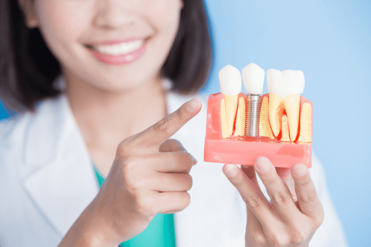 Implantes de zirconio