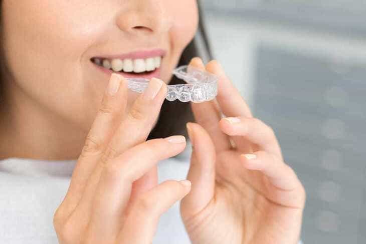 Ventajas ortodoncia invisible